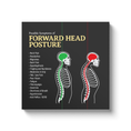 Load image into Gallery viewer, Chiropractic Poster: Forward Head Posture Symptoms