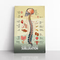 Load image into Gallery viewer, Chiropractic "Subluxation" Spine, Organ, Nerve Canvas Wrap