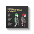 Load image into Gallery viewer, Chiropractic Poster: Forward Head Posture Symptoms
