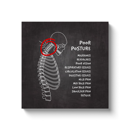 Chiropractic Poster: Affects of Poor Posture Canvas Wrap