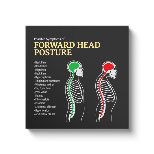 Chiropractic Poster: Forward Head Posture Symptoms