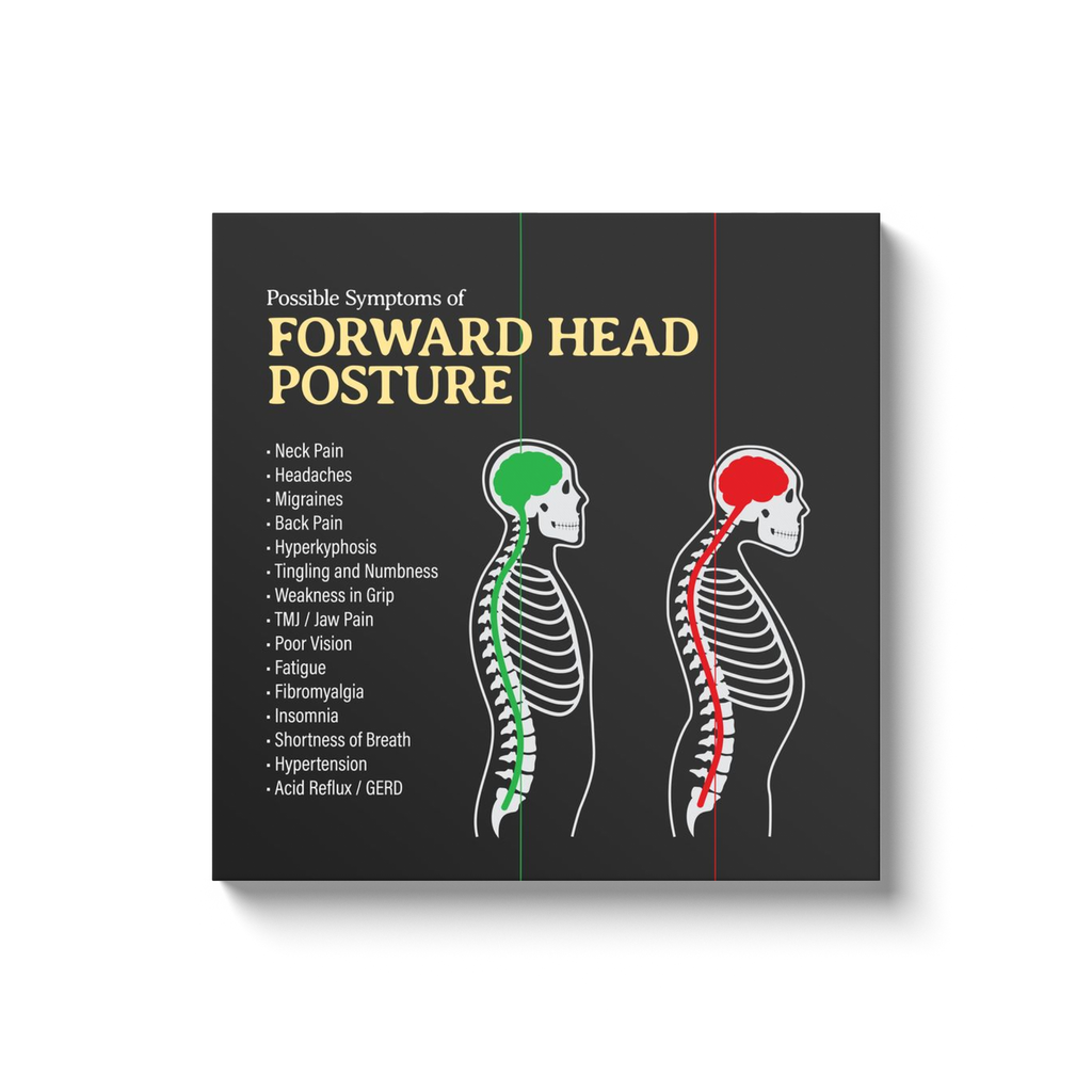 Chiropractic Poster: Forward Head Posture Symptoms