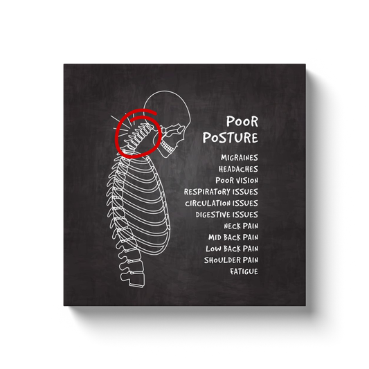 Chiropractic Poster: Affects of Poor Posture Canvas Wrap
