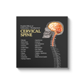 Load image into Gallery viewer, Chiropractic Poster: Cervical Spine Symptoms Canvas Wrap
