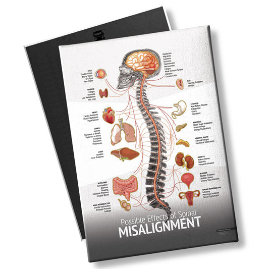 Chiropractic "Misalignment" Spine, Organ, Nerve Chart
