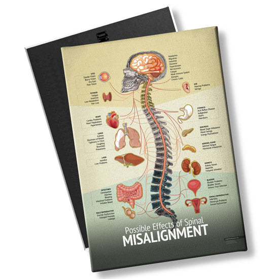 Chiropractic "Misalignment" Spine, Organ, Nerve Chart