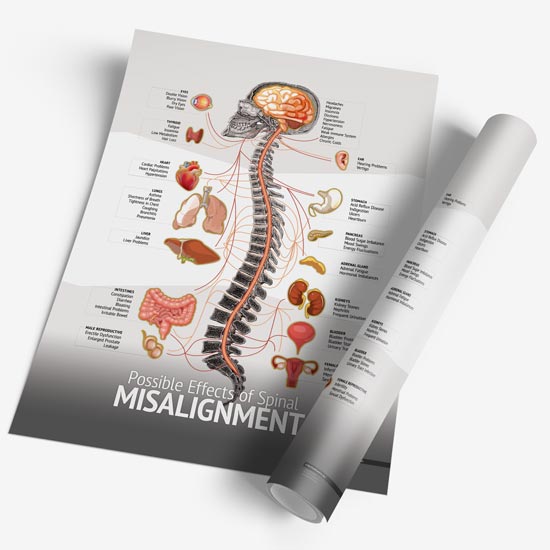Chiropractic "Misalignment" Spine, Organ, Nerve Chart - MyChiroPractice | Chiropractic Posters