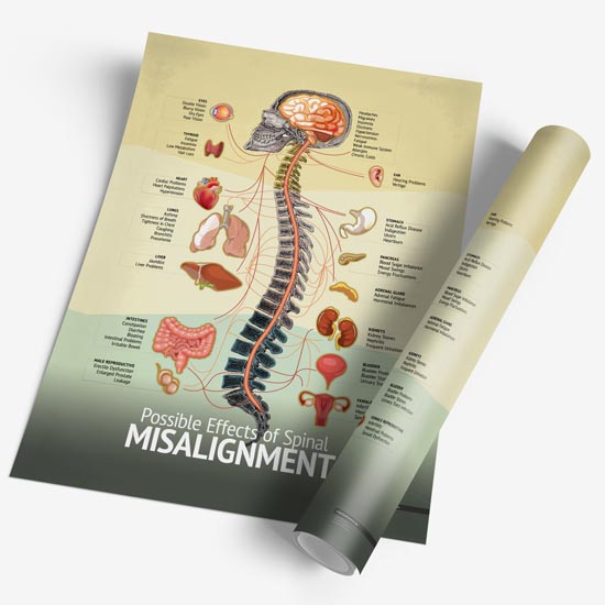 Chiropractic "Misalignment" Spine, Organ, Nerve Chart - MyChiroPractice | Chiropractic Posters